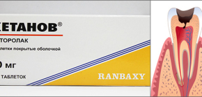 Ketanov-tabletter för att lindra tandvärk och recensioner om deras användning