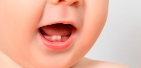 À propos de la morsure (temporaire) de lait, ainsi que de la dentition et du changement de dent chez les enfants