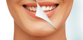 Which tooth whitening is the safest and most gentle for enamel?