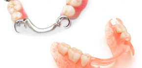 أطقم الأسنان القابلة للإزالة مع غياب جزئي للأسنان: أيهما أفضل؟