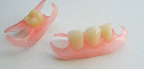 Răng giả và các sắc thái quan trọng của chân giả với sự giúp đỡ của họ