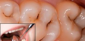 كيف يتم علاج طب الأسنان في طب الأسنان اليوم