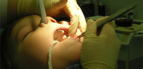 Extraktion von Zähnen unter 