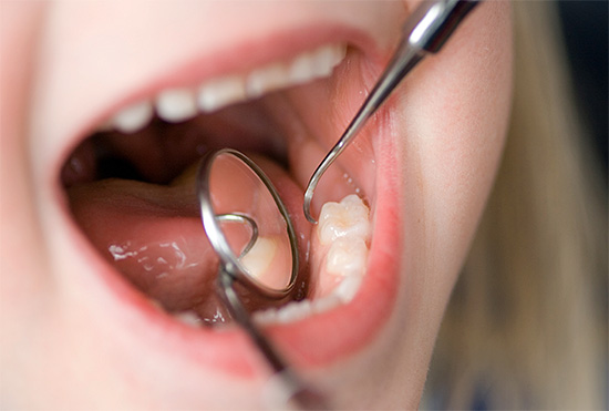 According to the severity of caries and its compensation, children are divided into three groups ...