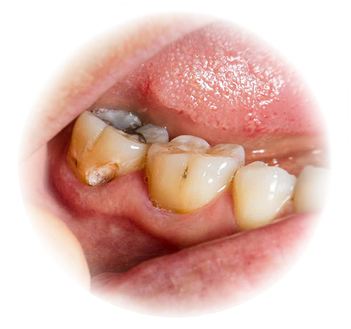 Useimpien unelmakirjojen mukaan sairaiden hampaiden kuva ei yleensä ole hyvä.