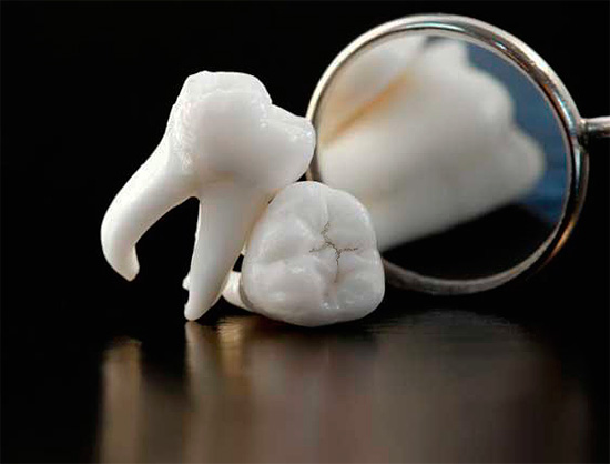 Menurut Autumn Dream Book, menarik gigi boleh membayangkan kesakitan fizikal yang akan datang dalam kehidupan sebenar.