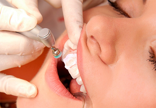 Un procedimiento muy útil para la protección contra la caries es un procedimiento de higiene profesional, cuando la placa y los depósitos minerales se eliminan de los dientes.