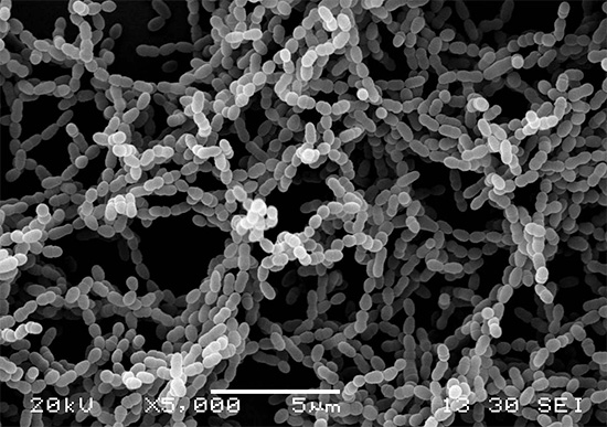 Ėduonies kolonijos Streptococcus mutans sukelia ėduonį
