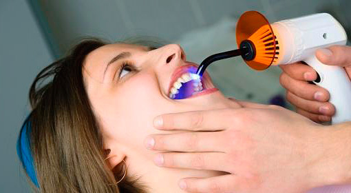 ในคลินิกที่ทันสมัยในการรักษาโรคฟันผุลึกวัสดุอุดแสงหายมักใช้บ่อยที่สุด