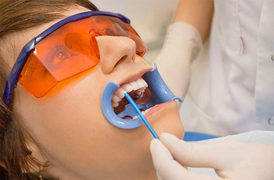 La cure de reminéralisation se termine généralement par un vernis spécial au fluorure recouvrant les dents.