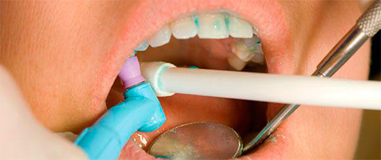 Med overfladisk skade på tennene er ofte remineraliserende terapi nok til å gjenopprette egenskapene til tannemaljen.