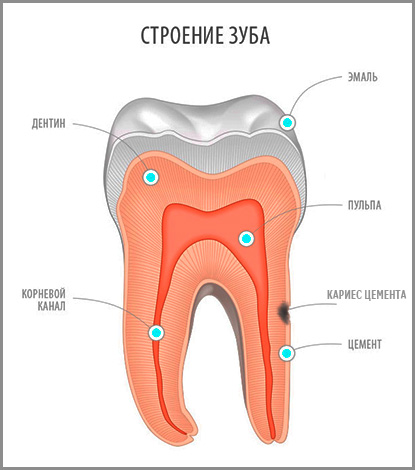 В стоматологичната практика кариесът на цимента е доста рядък, но тази патология е много коварна и ако не се лекува, лесно може да доведе до загуба на зъб ...