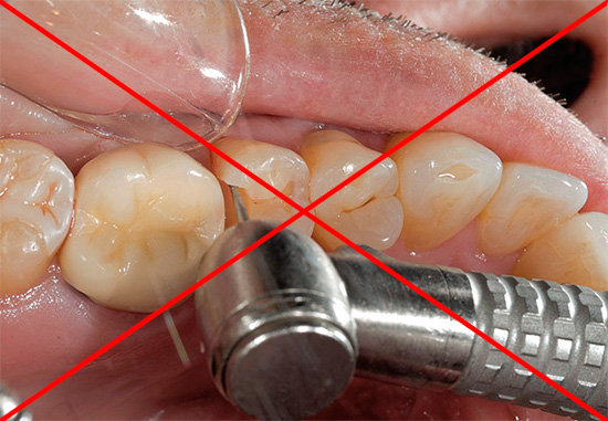 Today, in the arsenal of dentists there are a number of methods that allow you to treat caries without using a drill.