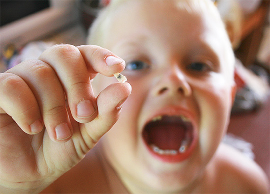 Let's talk about methods for preventing the development of caries in children ...