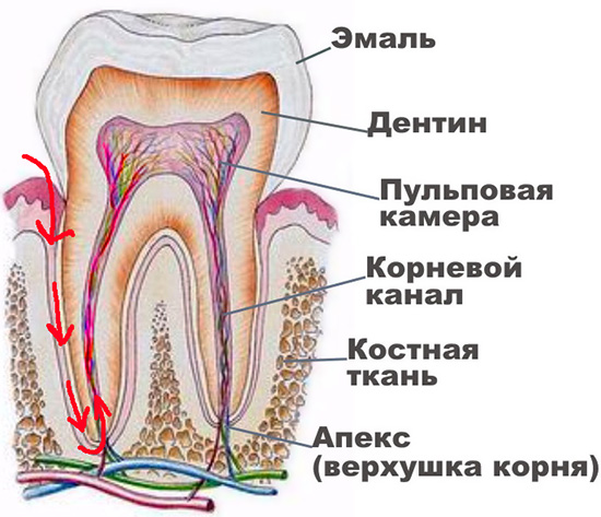 S retrogradnim pulpitisom, infekcija ne prodire u zub kroz karijesnu šupljinu, već kroz vrh korijena.