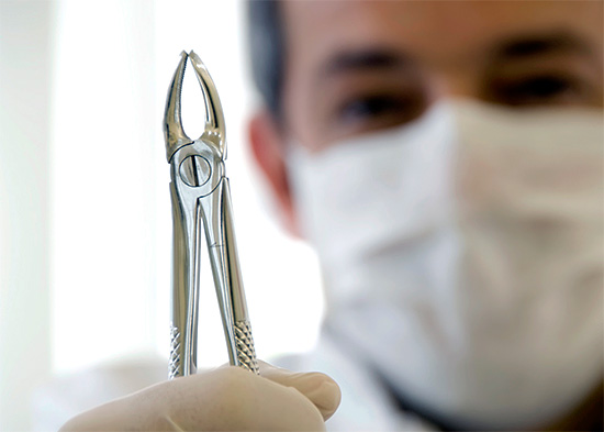 Con una semplice lacerazione di un dente del giudizio, vengono utilizzati solo una pinza dentale o un ascensore.