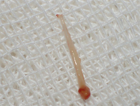 Photo of pulp extracted from a tooth