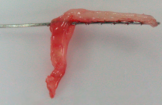 Aquí hi ha un altre exemple de nervi extret d’una dent.
