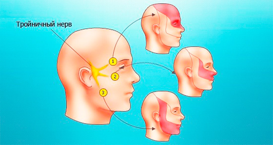 في التهاب لب السن الحاد المنتشر ، يمكن أن ينتشر الألم الشديد على طول فروع العصب الثلاثي التوائم في أجزاء مختلفة من منطقة الوجه والفكين.