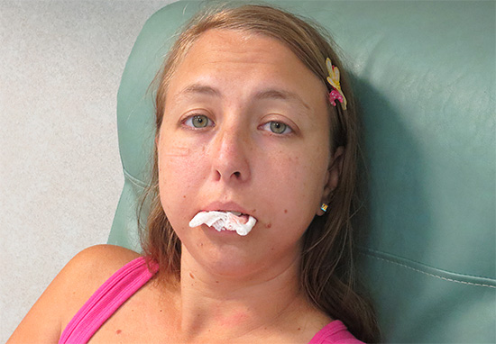 Kanamayı durdurmanın en kolay yolu, dişleriniz (veya diş etleri) arasında bir gazlı bez sıkmaktır.