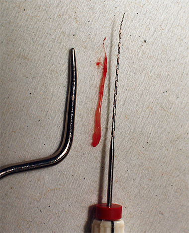 La foto mostra la polpa estratta dal canale dentale.