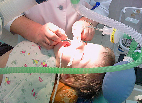 Tubul respirator și alte echipamente intervin uneori cu medicul care efectuează manipulări în cavitatea bucală a pacientului.