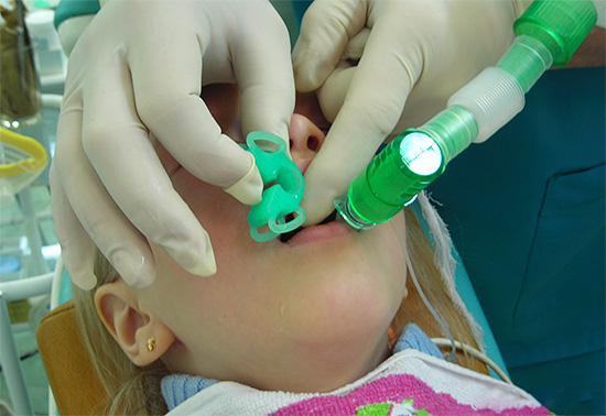 Si l'enfant a très peur de traiter ses dents, le recours à l'anesthésie générale peut être presque le seul moyen de prodiguer des soins dentaires normaux.