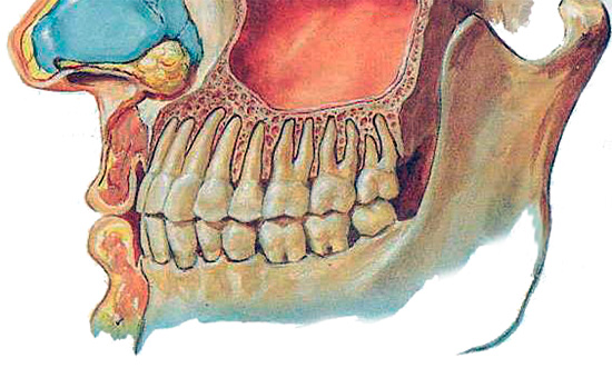 In diesem Bild können Sie deutlich sehen, wie nahe die Wurzeln der oberen Zähne am Sinus maxillaris liegen.