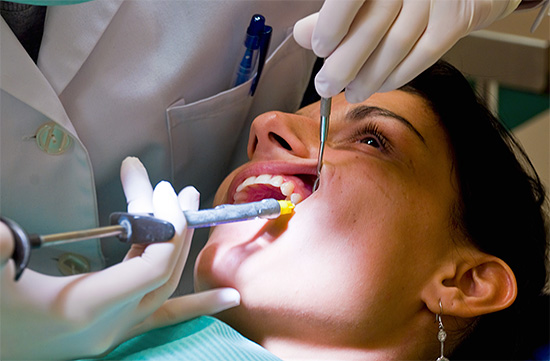 Sebagai peraturan, apabila mengeluarkan gigi bijak, anestesia tempatan adalah mencukupi.