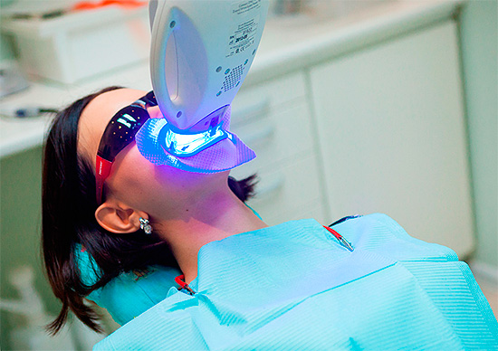 La technologie de blanchiment des dents implique l'activation d'un gel de blanchiment à l'aide d'une lampe spéciale (par exemple, les ultraviolets).