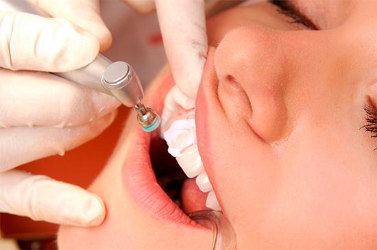Při mechanickém bělení se z povrchu zubů odstraní skvrny - plak a kámen.