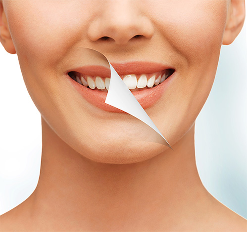 Jak bezpiecznie wybielić zęby przy minimalnym szkodliwym wpływie na szkliwo i ogólnie jest to możliwe - spróbujmy zrozumieć ten temat bardziej szczegółowo ...