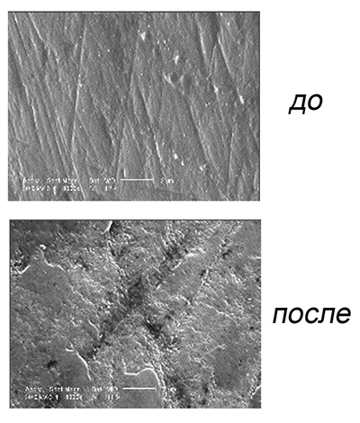 Gambar-gambar permukaan enamel gigi di bawah mikroskop sebelum dan selepas pelunturan kimia.