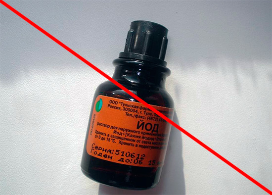 Katulad nito, ang isang solusyon sa iodine alkohol ay hindi dapat gamitin.