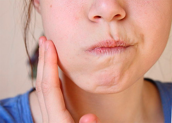 Pri správnom vypláchnutí úst sa môžete skutočne účinne zbaviť zubov, ale tu je dôležitý kompetentný prístup ...