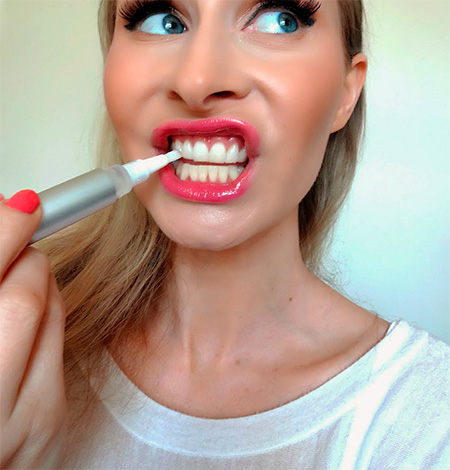For teeth whitening at home, the so-called whitening pencils are very popular today.