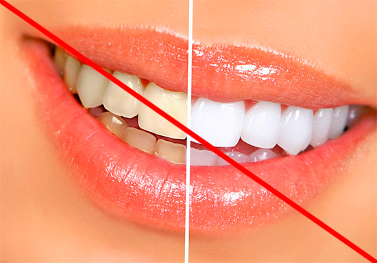 Du kan inte förvänta dig att en vitande tandkräm ger dig ett snövitt leende, men det är ganska kapabelt att göra det lite vitare (men inte i alla fall).