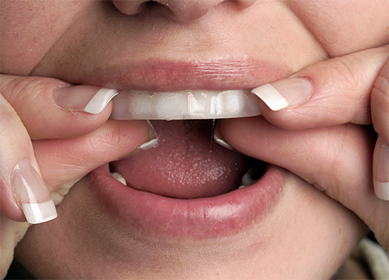 You can whiten your teeth at home using the so-called whitening strips ...