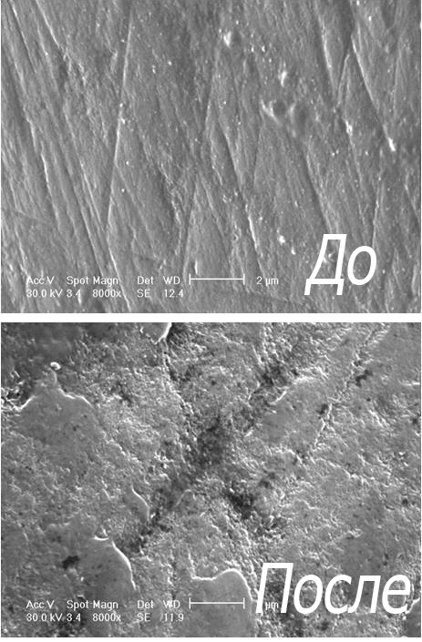 Фотографије зубне цаклине под микроскопом пре и после избељивања (коришћење гела на бази водоник пероксида и фосфорне киселине).
