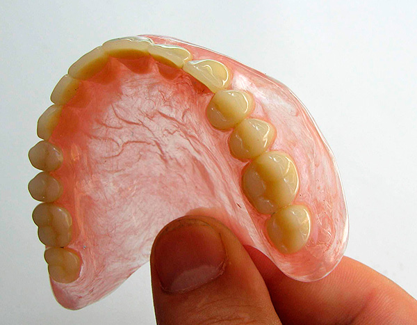 A complete denture is an alternative to dental implants, but far from the most pleasant.