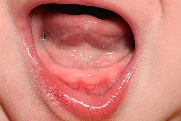 Hi ha situacions en què les dents de llet del nadó no esclaten durant molt de temps.