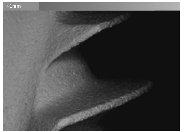 De foto toont het oppervlak van het Alpha Bio-implantaat onder een microscoop.