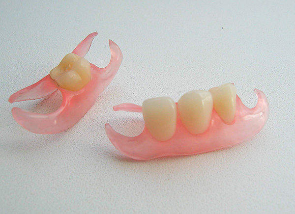 Takozvane leptir proteze također su često izrađene od akrilne plastike.
