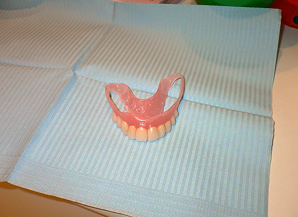 Nylon denture on the upper jaw.