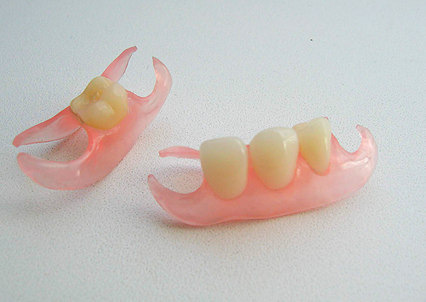 Let's talk about butterfly dentures and what to consider when using them ...
