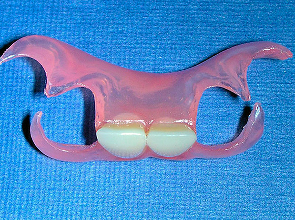 Fotografie ukazuje motýlovou protézu pro protetiku dvou předních zubů.