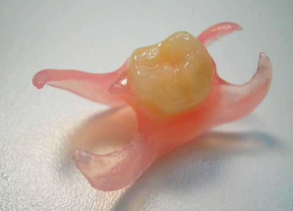 Y esta es una prótesis de un diente de mascar.
