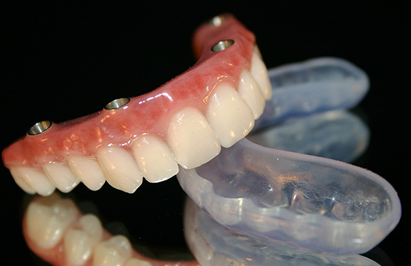 ฟันปลอม (All-on-4)