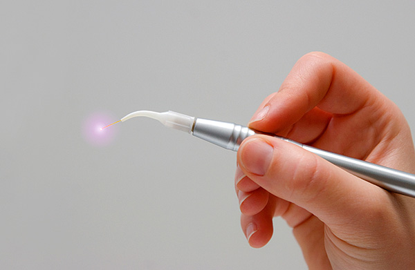 Nykyään monien hammasklinikoiden mainonnasta löydät palvelun hammaskystojen hoitamiseksi laserilla ...