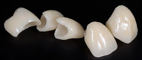 Zirconia crowns are the most expensive.